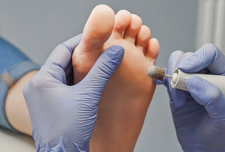 foot wart doctor)